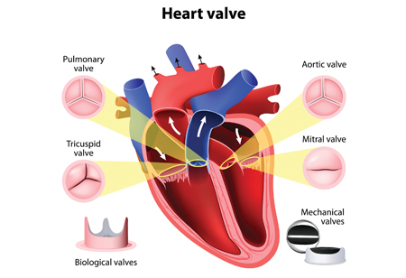 Advances in heart valve treatments