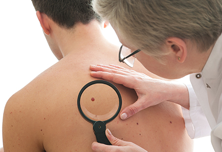 Eight things you should know about skin cancer from dermatology experts at HonorHealth