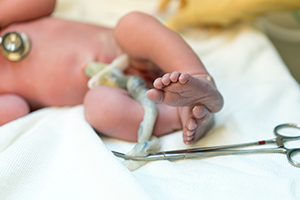 Umbilical cord care