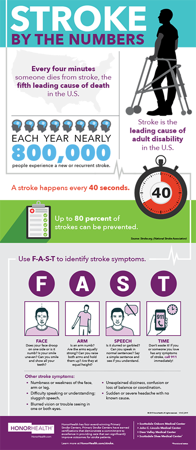 Stroke by the numbers - click for the full infographic