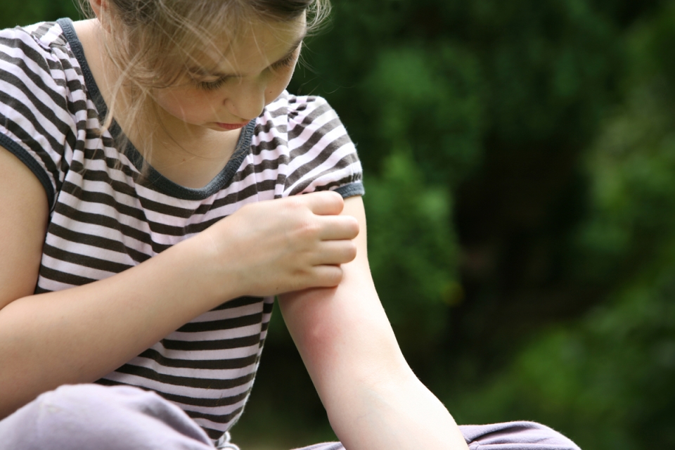 How to deal with bites and stings for kids in Arizona.