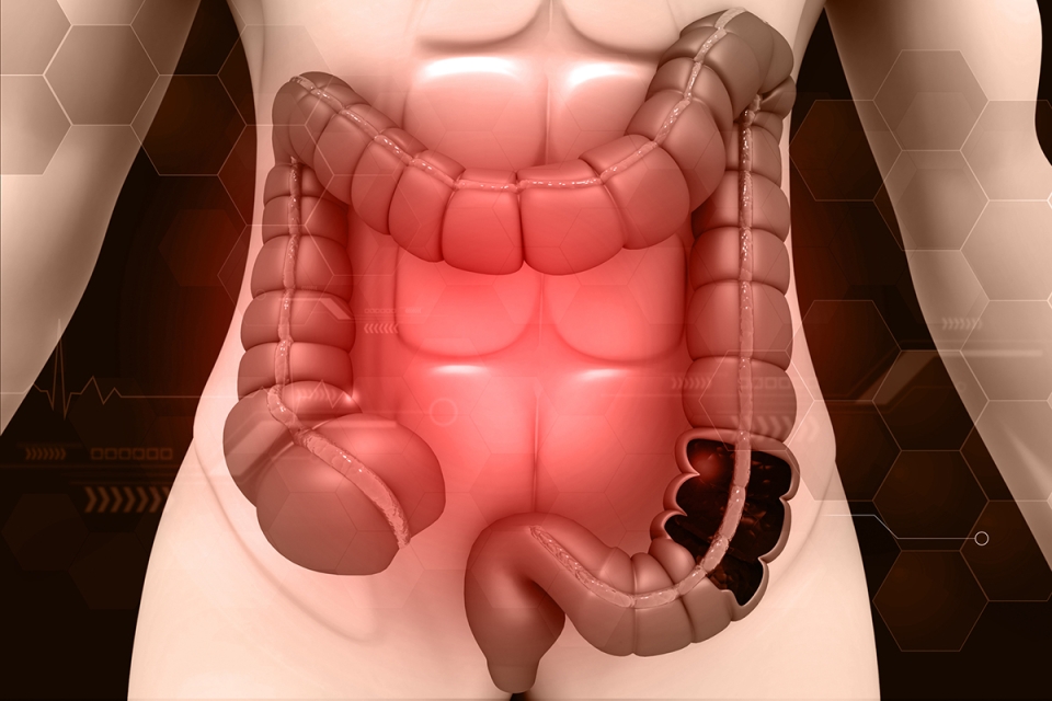 Colon Cancer Screening Options - HonorHealth