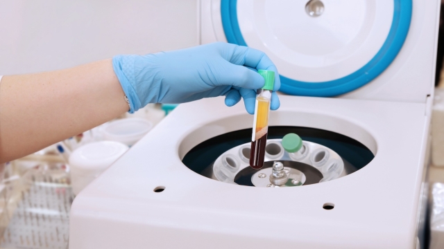 HonorHealth performing platelet-rich plasma therapy