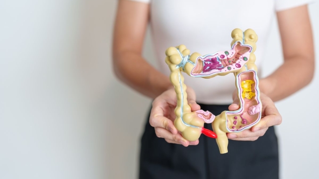 HonorHealth Women GIving Care Program - Woman holds GI system model.